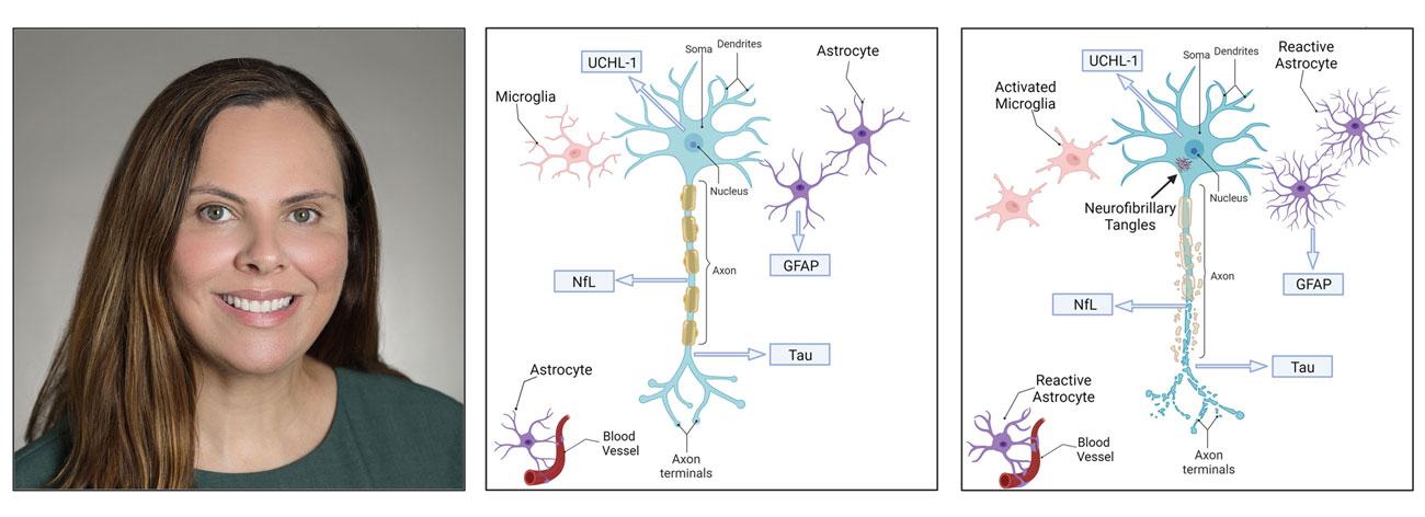 Headshot of Dr. Guedes next to two figure panels showing the different between a healthy brain cell and a brain cell post-injury