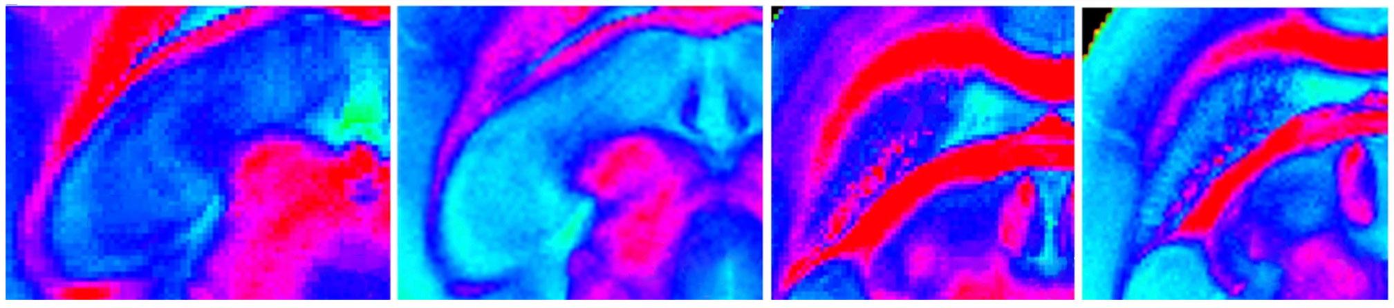 Colorful microscopy images showing close-ups of a mouse brain after radiation treatment