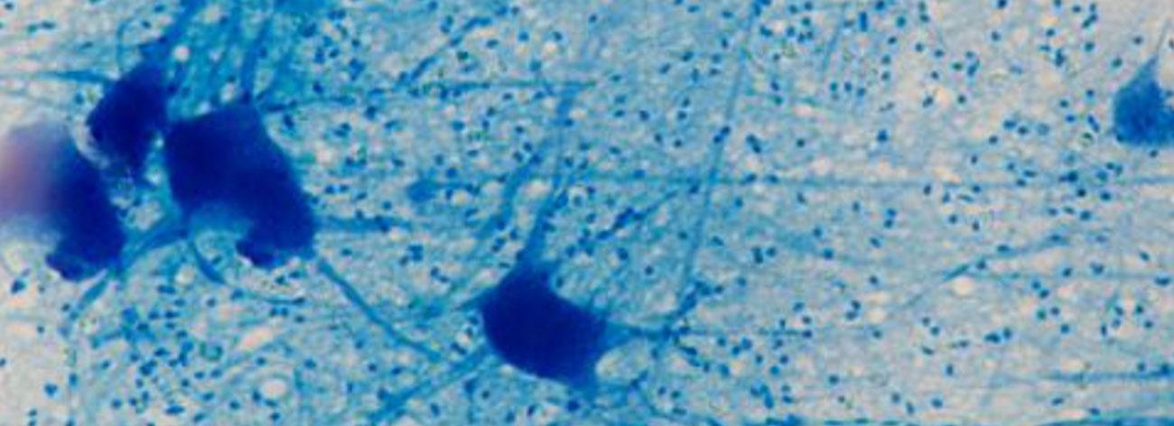 Blue microscopy image of brain cells up close