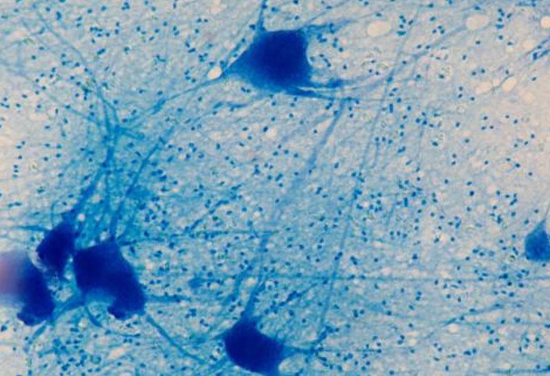Blue microscopy image of brain cells under a microscope