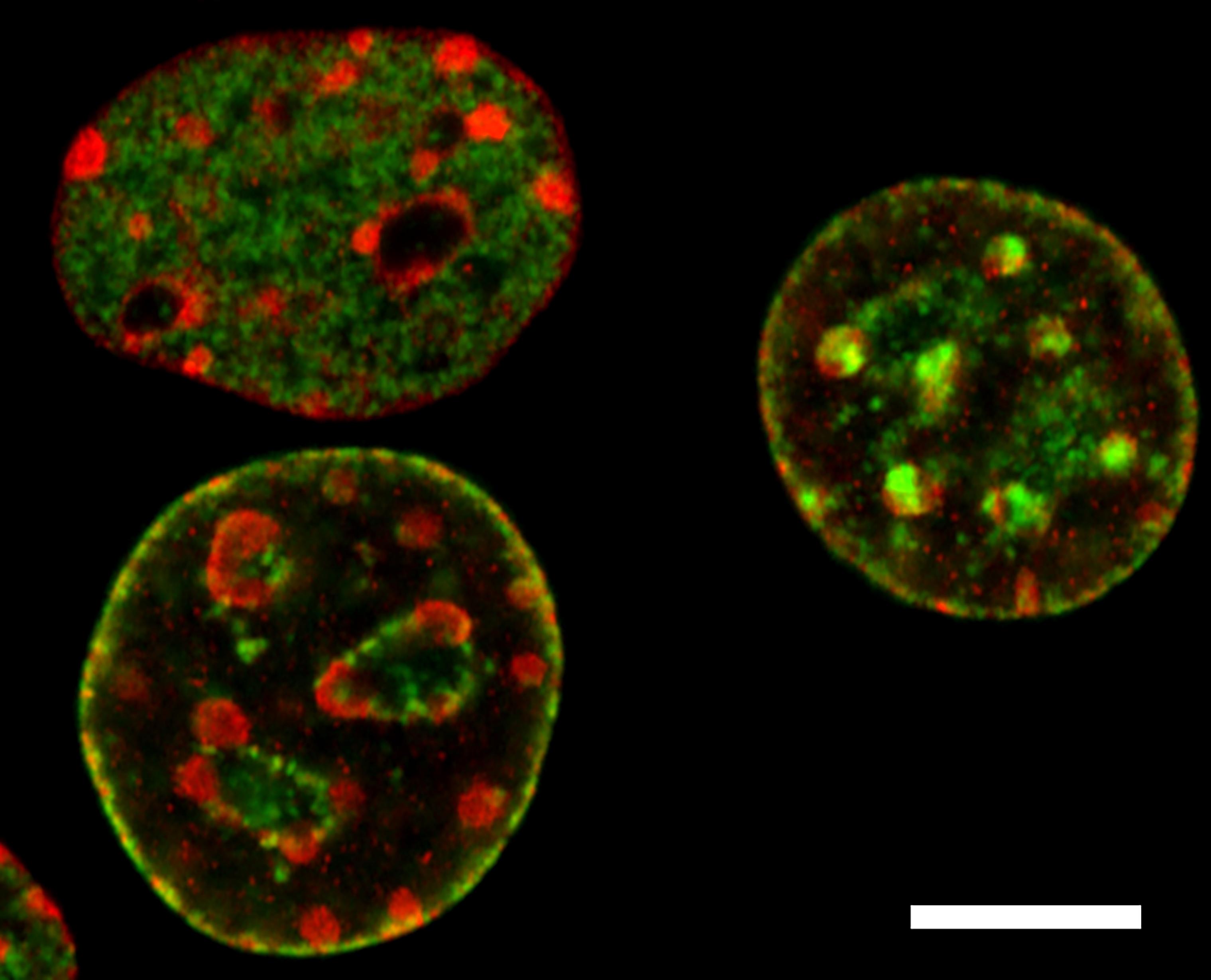 Super-resolution light microscopy images of metastatic tumor cell nuclei immunolabeled against histone post-translational modifications (H3K9me3, red) and histone variants (H3.1, green).