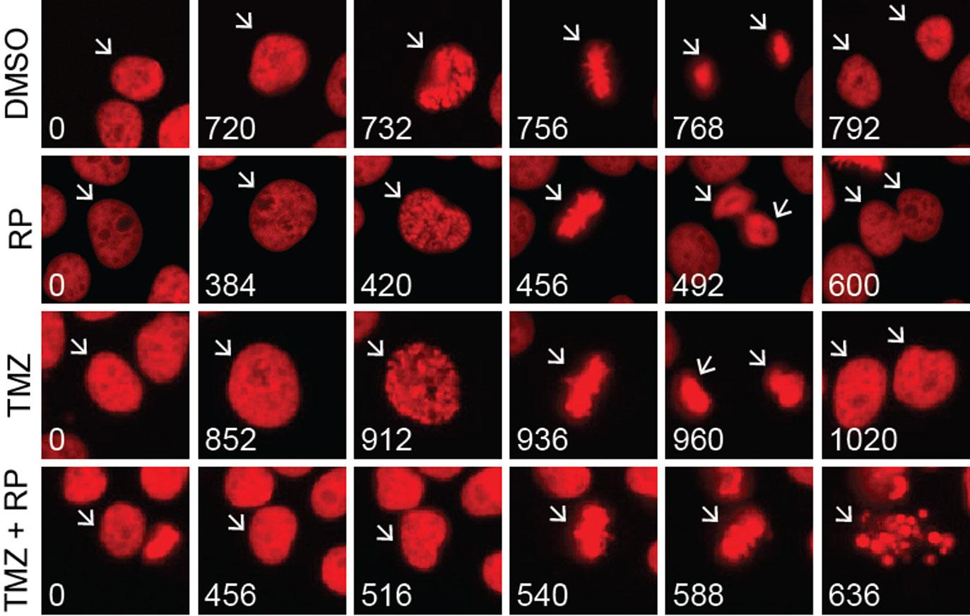 Microscopy images showing cells treated with RP-6306 alone, TMZ alone, and a combination of TMZ and RP-6306.