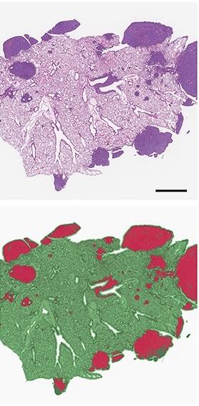 Representative H&E tissue staining (top) and corresponding pseudocolor markup (bottom) of identical images segmented as tumor (red) or lung plus non-neoplastic thoracic tissue (green), as published in Wei et al. 2020.