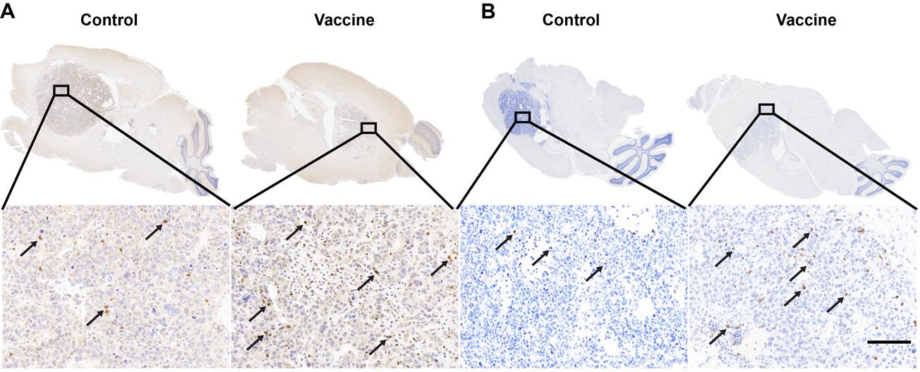 CD4 and CD8 staining of mouse brain tumor tissue confirming that immune cells called CD4+ T cells and CD8+ T cells are both increased in the vaccine group.