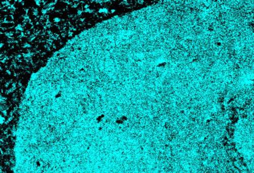 A microscopy image showing how an AI tool could identify tumor tissue (blue) vs. non-tumor tissue (black).