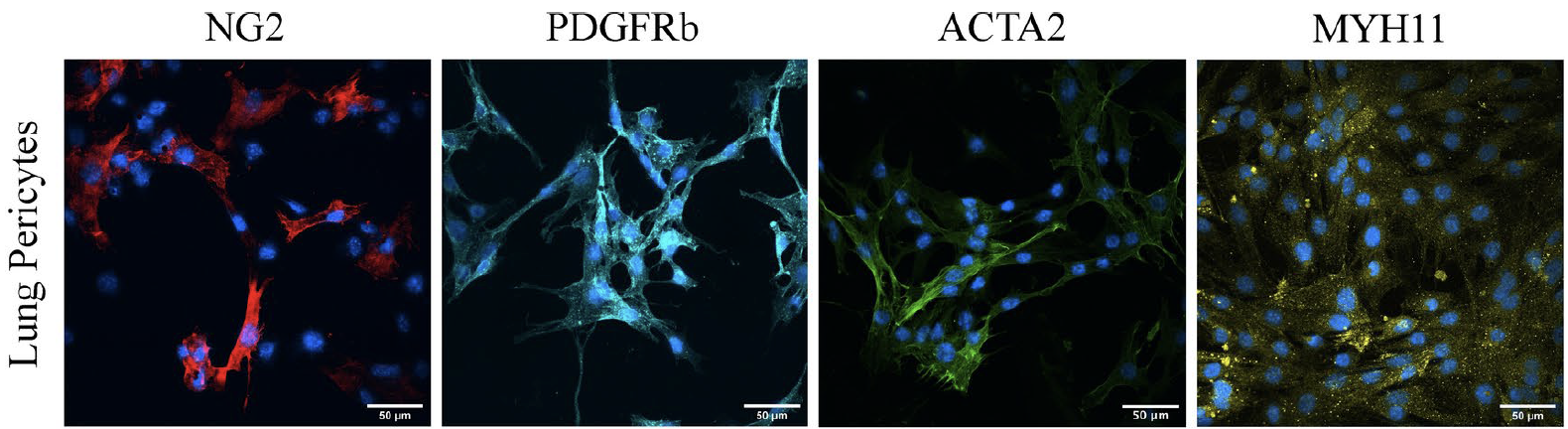 Immunofluorescence characterization of primary pericyte cultures from mouse.