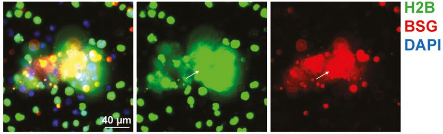 Immunofluorescence staining of cell adhesion proteins and TuNEPs