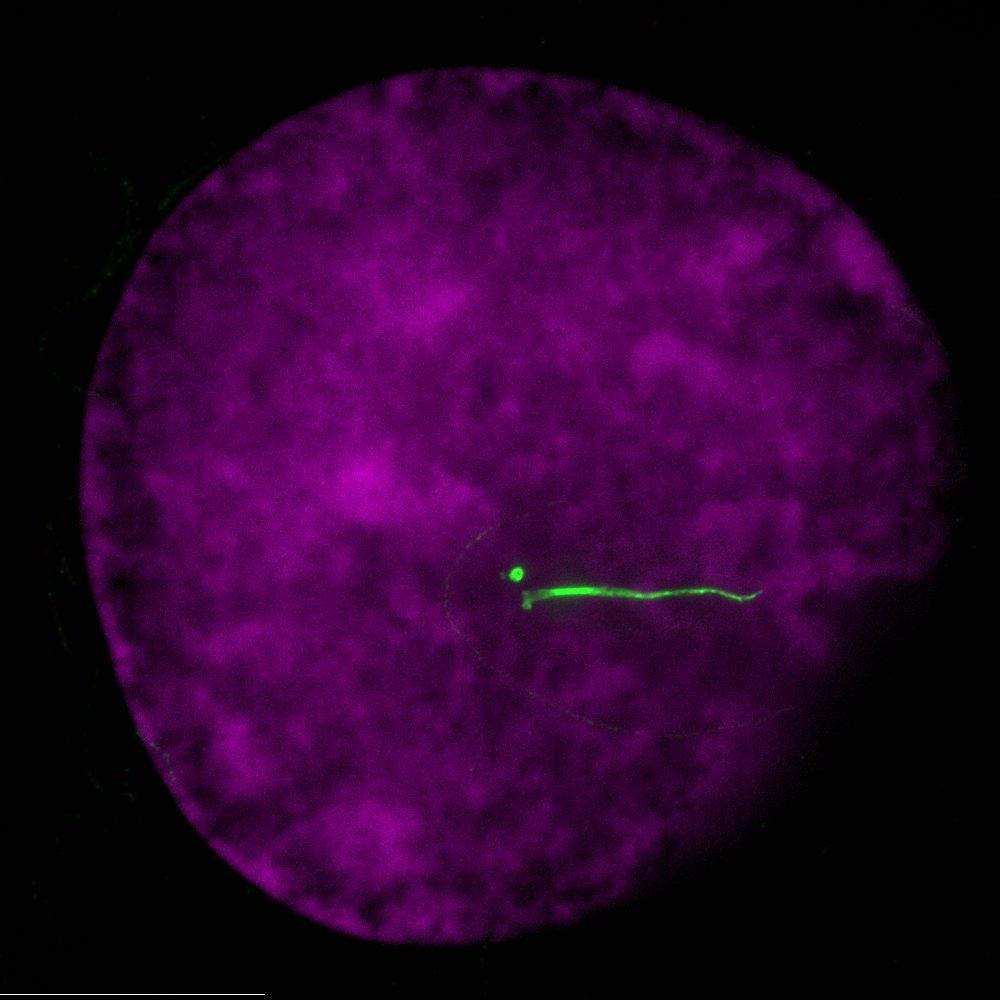 Primary cilium