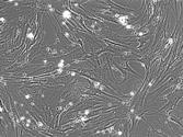 Picture 8 - Microscopic image of fibroblasts, which are normal cells in the body, in this case the lung