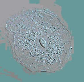 Picture 2 - A single skin cell viewed under a microscope