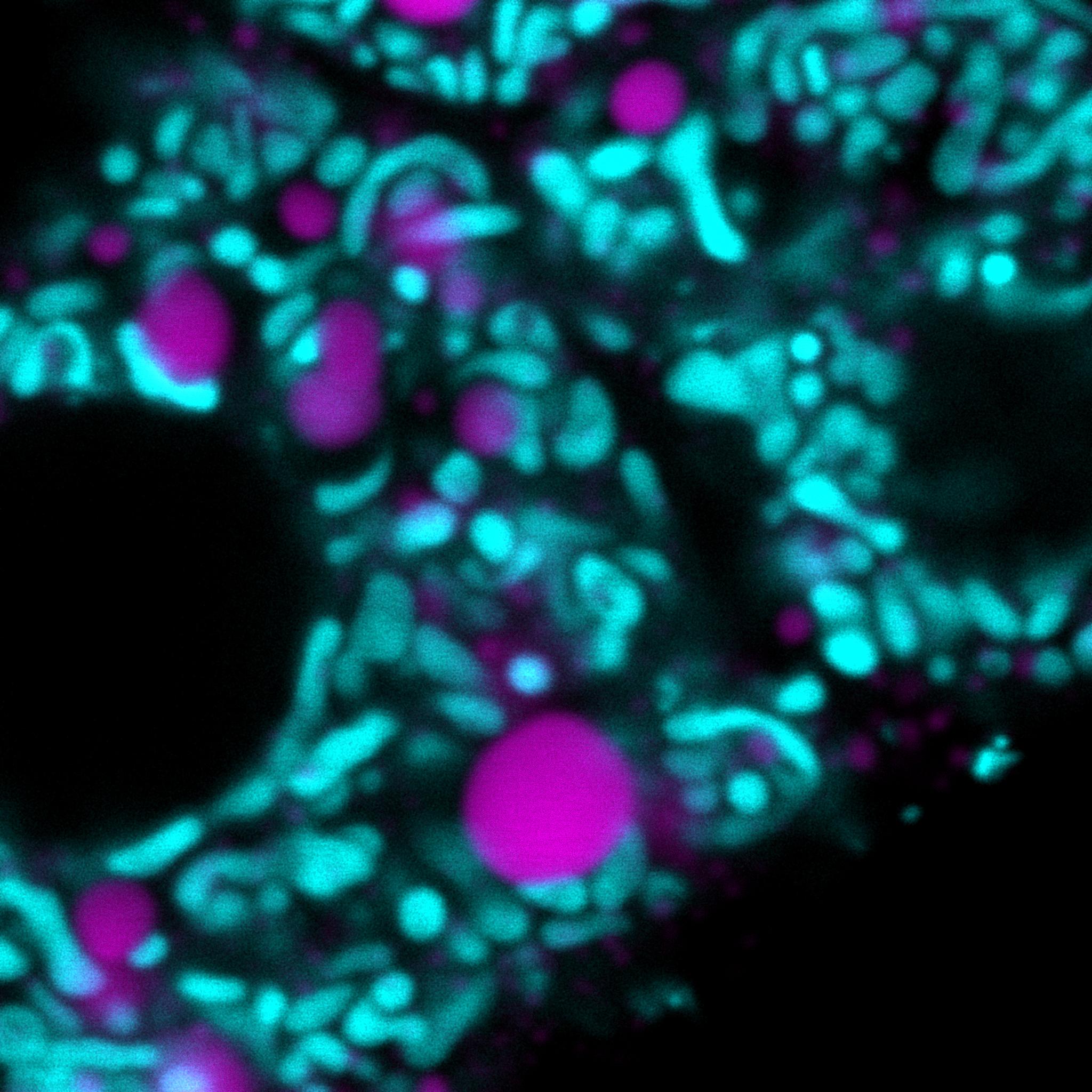 Close up on hepatocytes in a liver section. Mitochondria (cyan), lipid droplets (magenta).
