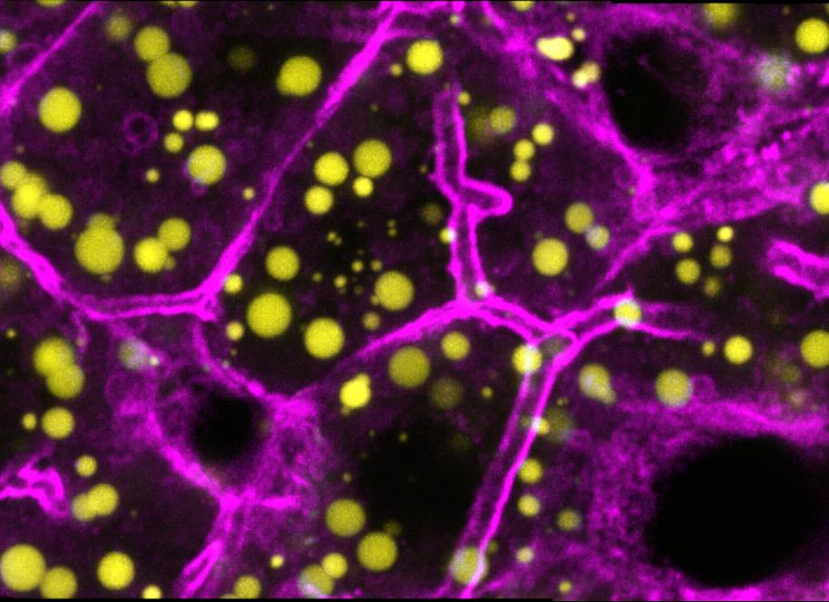 Close up on hepatocytes in a liver section. Actin (magenta), lipid droplets (yellow)
