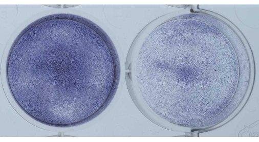 Picture 8 - The cells in the plate were coated with a blue dye that stains all cells