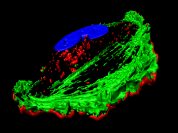 Microscopy image of glioma cell color-coded in red, green, and blue